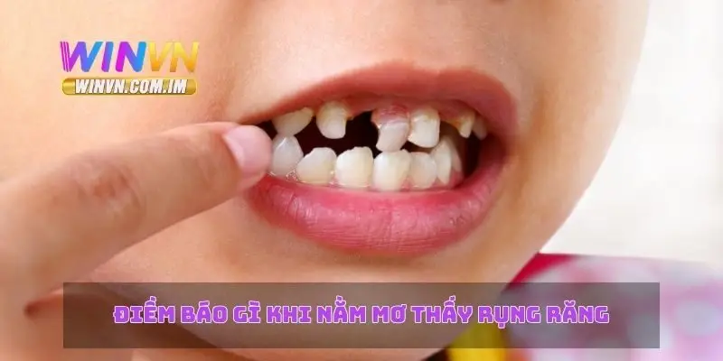 Nằm Mơ Thấy Rụng Răng – Ý Nghĩa Và Các Điềm Báo Liên Quan 2 Điềm báo gì khi nằm mơ thấy rụng răng